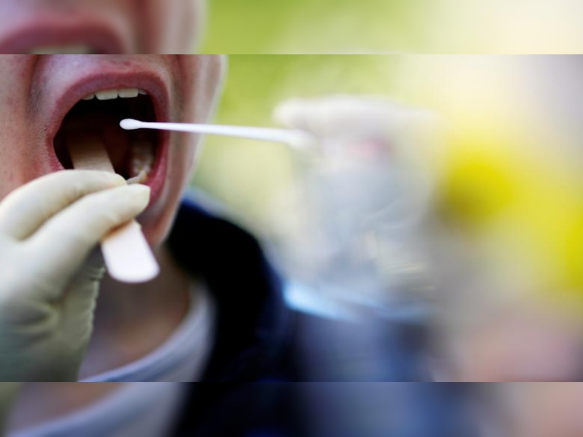 DNA Explainer: What is COVID tongue and what are its symptoms?