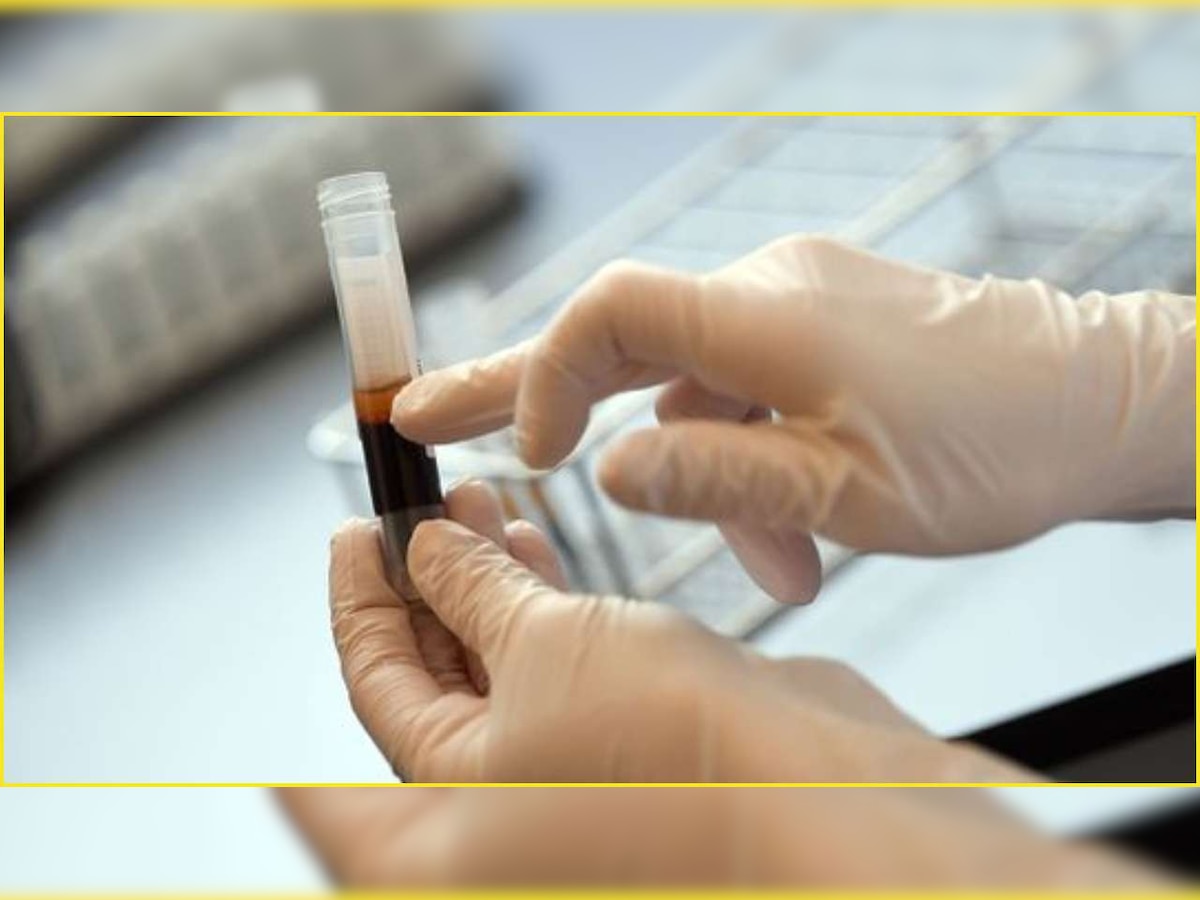 COVID-19: Who can be a plasma donor? Know all details here
