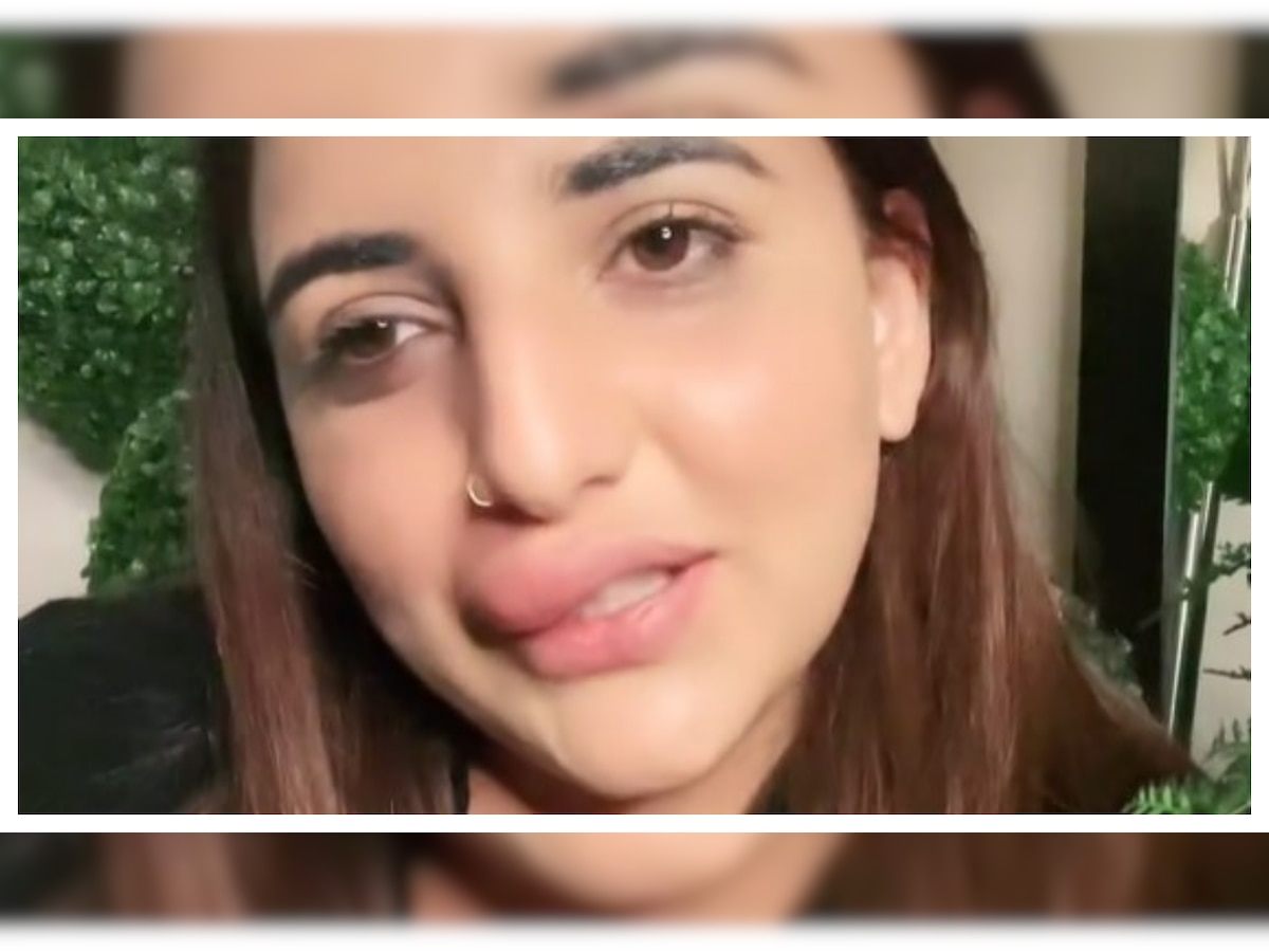 Pakistani TikTok star gets botched lip fillers in viral video - WATCH here