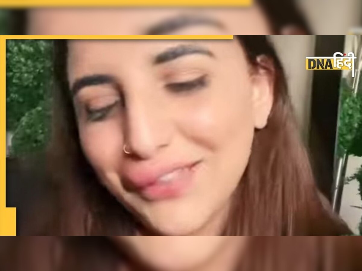 बैंक अकाउंट हुआ फ्रीज आधे में रोकनी पड़ी Lip Surgery, बिगड़ा Tik Tok Star का चेहरा