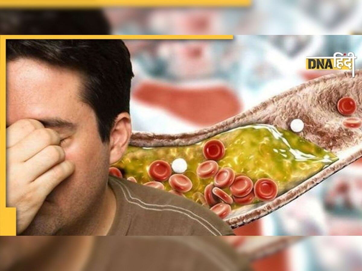 क्या होता है Bad Cholesterol ? जो बढ़ा सकता है हार्ट अटैक का खतरा