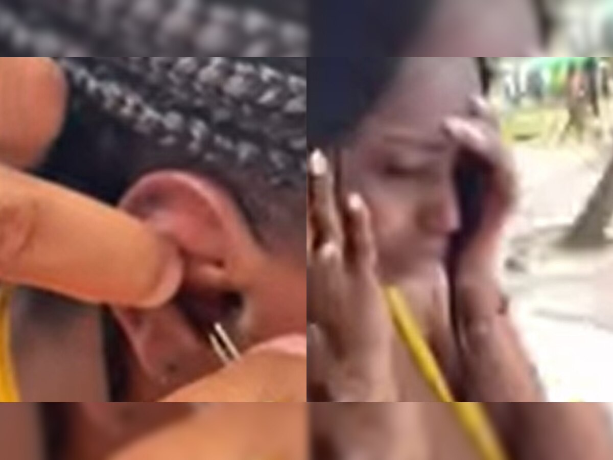 Live crab stuck inside woman’s ear horrifies netizens – WATCH viral video