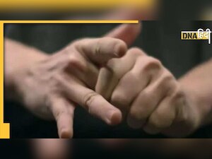 Health Tips: उंगलियां चटकाने पर क्यों आती है आवाज, बार-बार ऐसा करना है कितना खतरनाक?