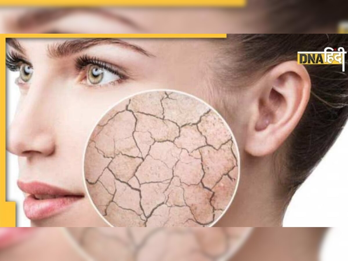 Dry Skin Care Tips: AC में रहकर ड्राई हो गई है त्वचा? ये आसान तरीके आएंगे काम