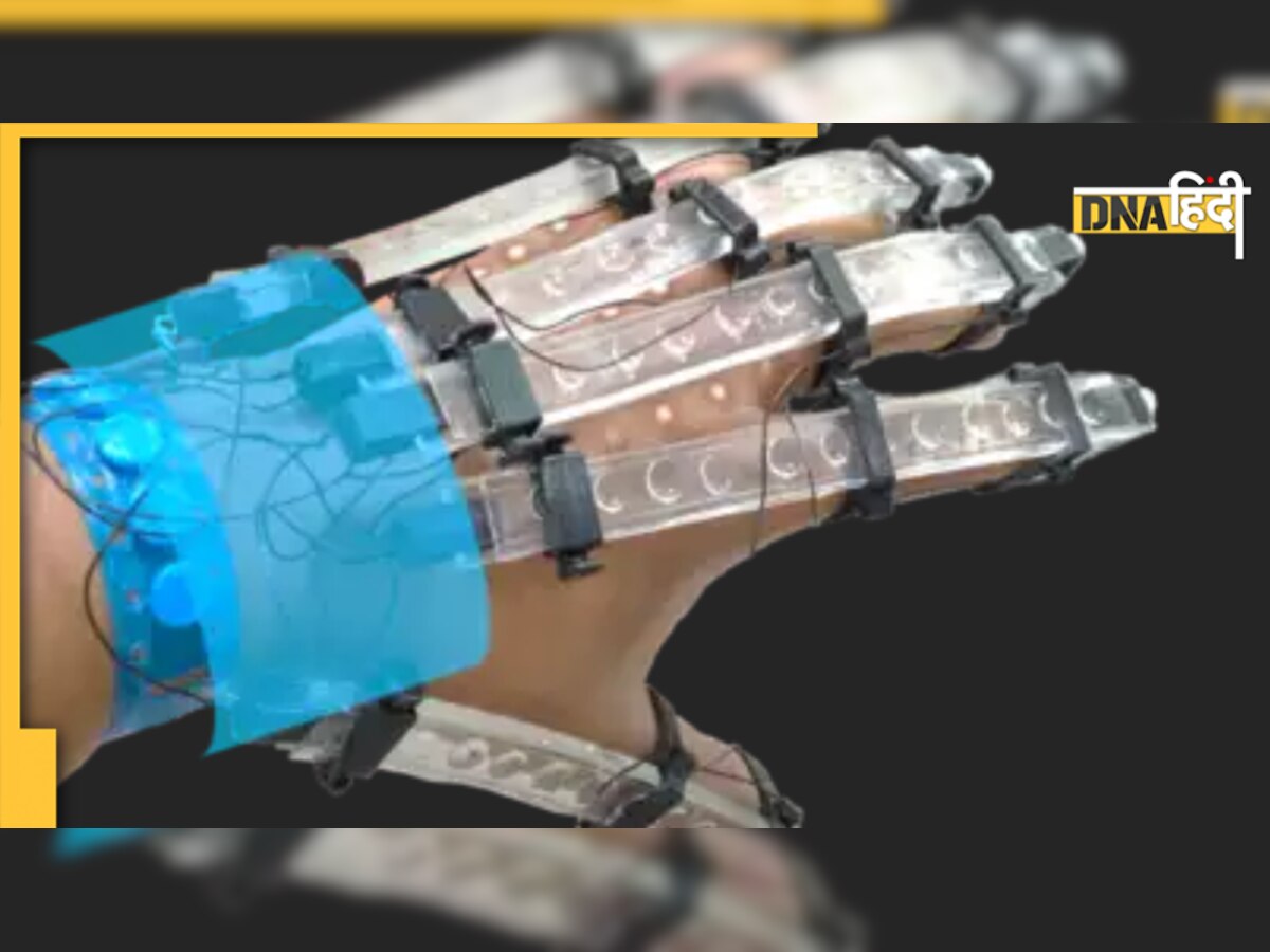  Stroke के मरीज़ों के लिए नये  3D प्रिंट वाले ग्लव्स, Physiotherapy में मिलेगा फ़ायदा  
