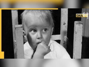 Parenting Tips: बच्चे की नाखून चबाने की आदत से हैं परेशान, ये तरीके आजमाएं