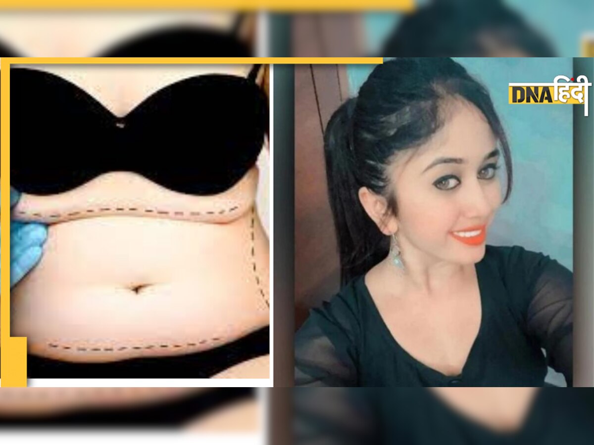 Fat Free Surgery के बाद ज़रूरी है कुछ चीज़ों का ध्यान रखना, नहीं तो हो सकता है बड़ा खतरा 