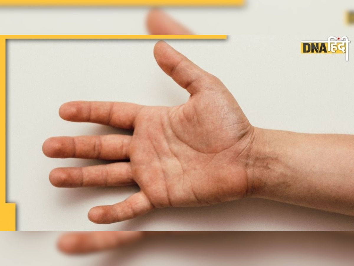 Palmistry : हथेली पर है H का निशान, 40 की उम्र  में हो सकती है यह ग़ज़ब की चीज़