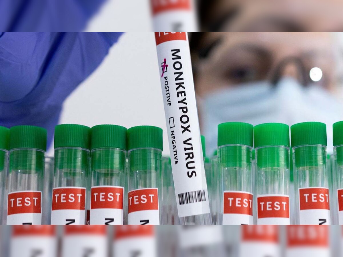 Is it possible for someone to be infected with both monkeypox and Covid-19 virus?