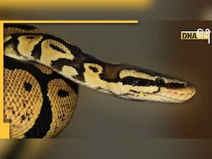 Toilet में बैठकर गेम खेल रहा था शख्स, सांप ने ऐसी जगह काटा दो हफ्ते तक निकले दांत के टुकड़े 