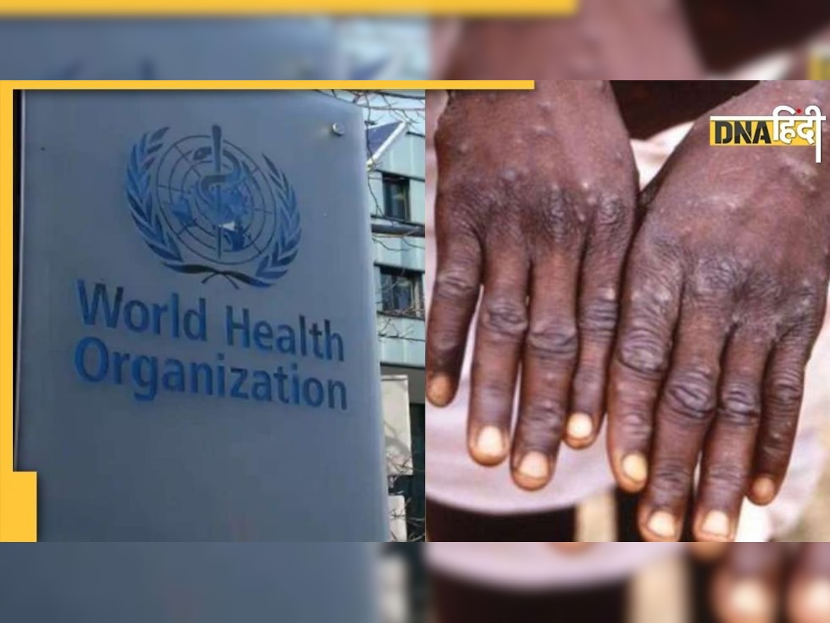 Monkeypox के बढ़ते संक्रमण के बीच आया WHO का बयान, लोगों को दी सतर्क रहने की सलाह