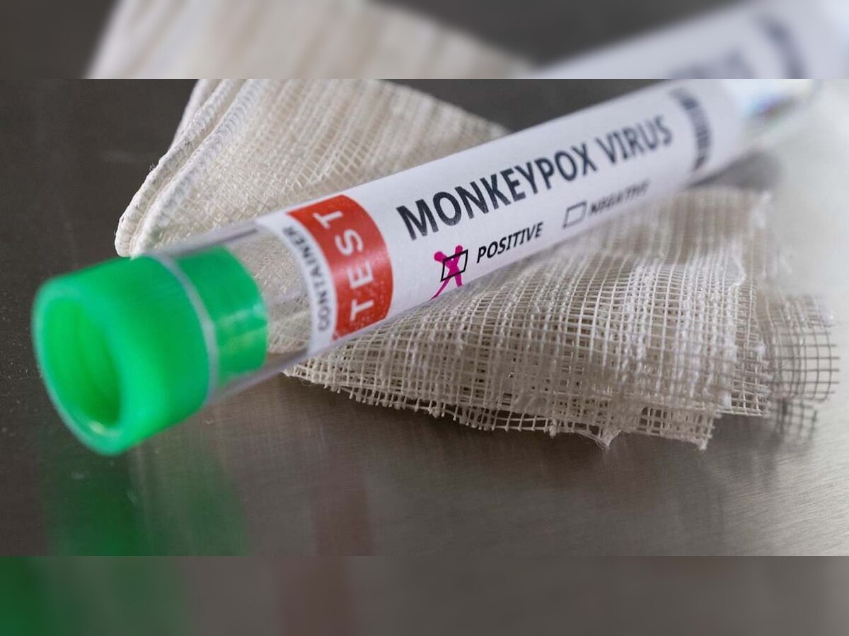 Fact check: Myths about the monkeypox viral infection busted