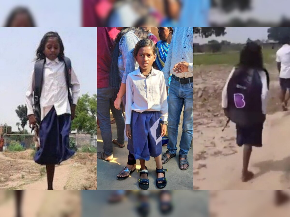 Bihar girl gets prosthetic leg after video of her travelling 1 km on 1 leg  goes