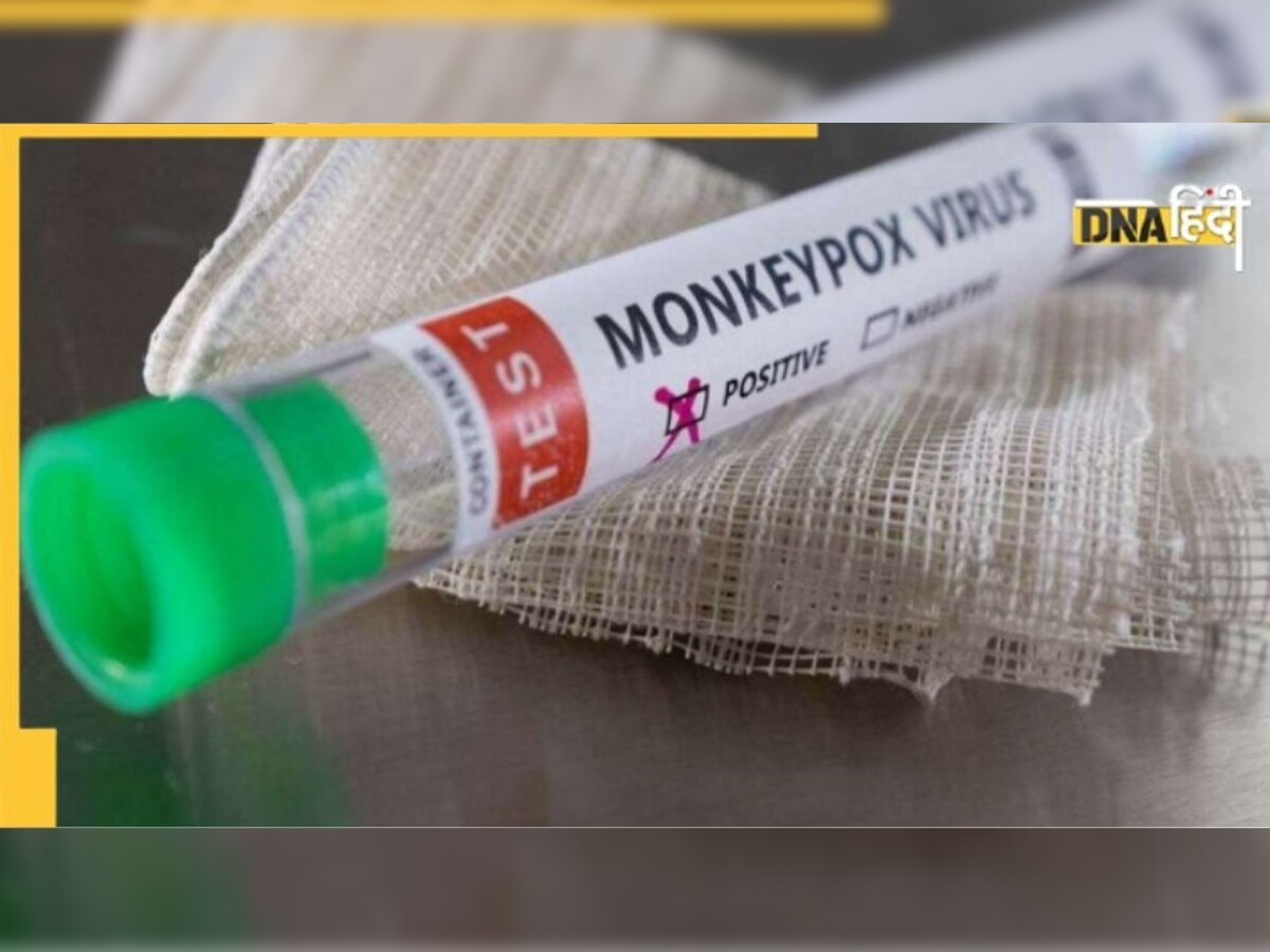  Monkeypox: घर बैठे हो जाएगा टेस्ट, लॉन्च हुई नई RT-PCR किट