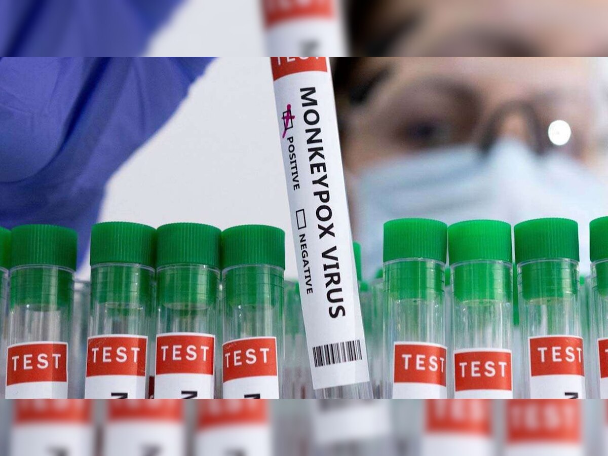 Reports of monkeypox in non-endemic countries suggests undetected transmission for some time: WHO 