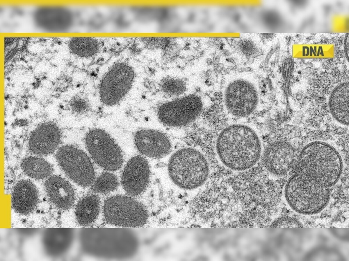 Monkeypox: Centre issues guidelines on management of disease