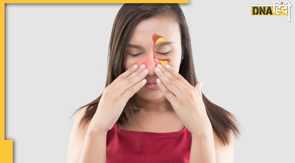 Home Remedies for Sinus साइनस की समस्या से हैं परेशान! ये चार आसान