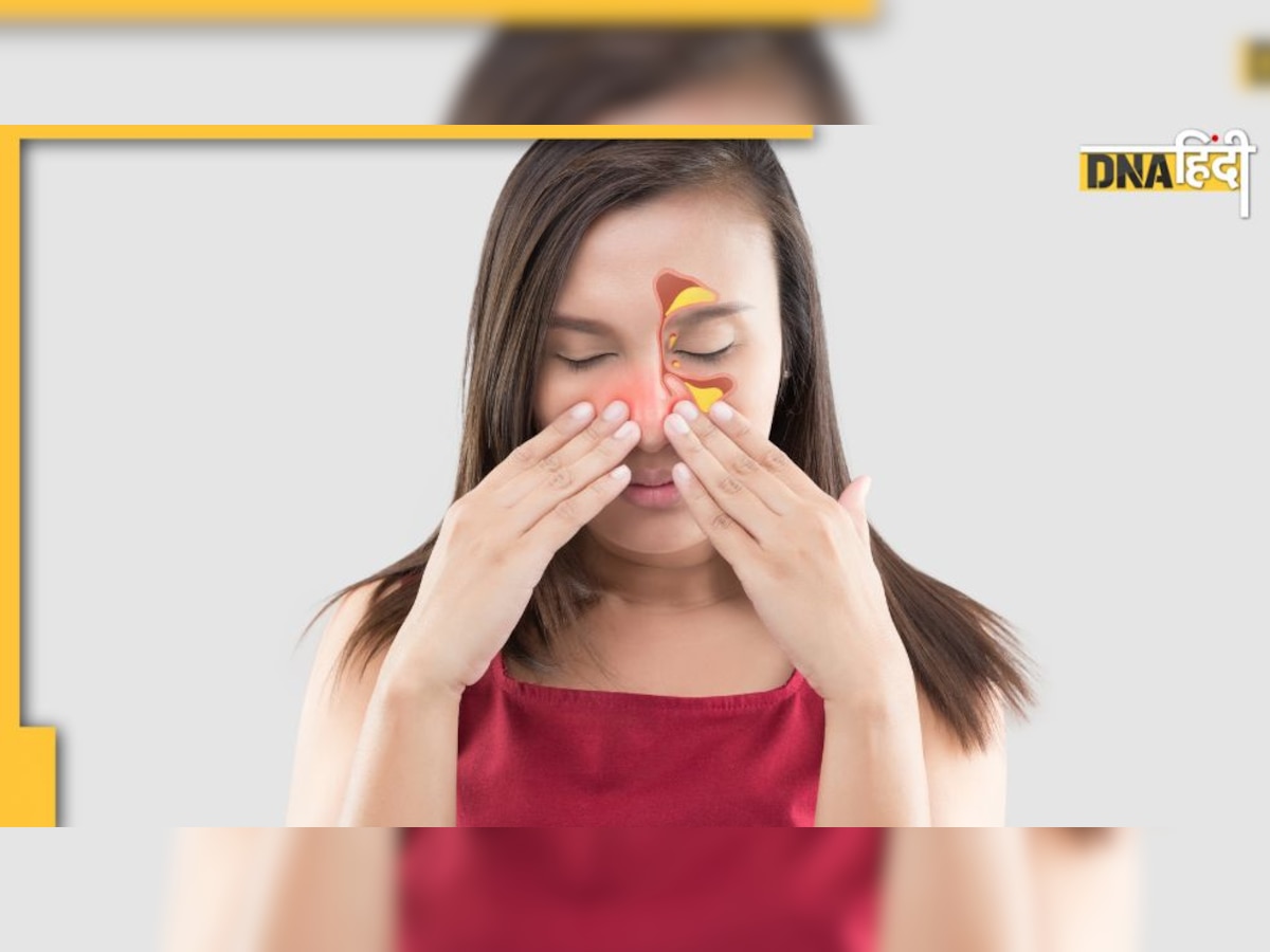 Home Remedies for Sinus: साइनस की समस्या से हैं परेशान! ये चार आसान उपाय करेंगे मदद