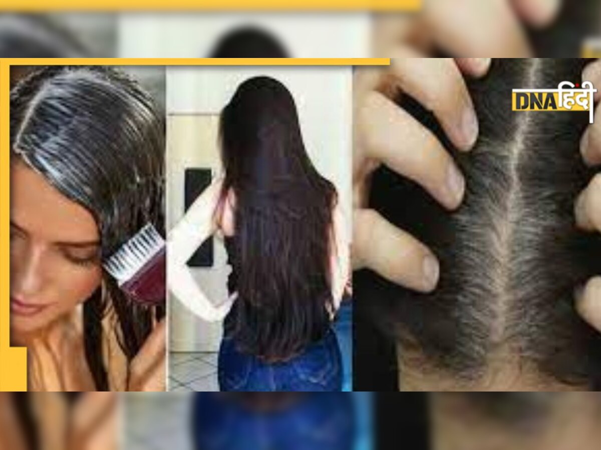 Hair Care Tips In Hindi: काले हो जाएंगे सफेद बाल, खाने में शामिल कीजिए यह शानदार चीज़