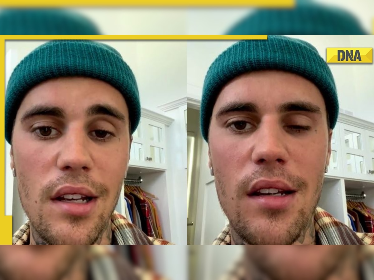 Justin Bieber reveals virus left half of his face paralyzed, says 'eye is not blinking'