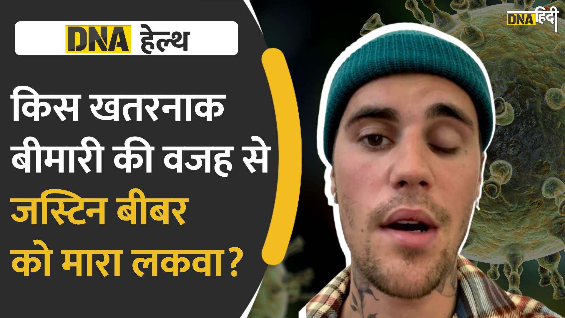 Video :  Justin को मारा लकवा, नहीं झपका पा रहे पलकें, जानें किस बीमारी से हुए ग्रसित