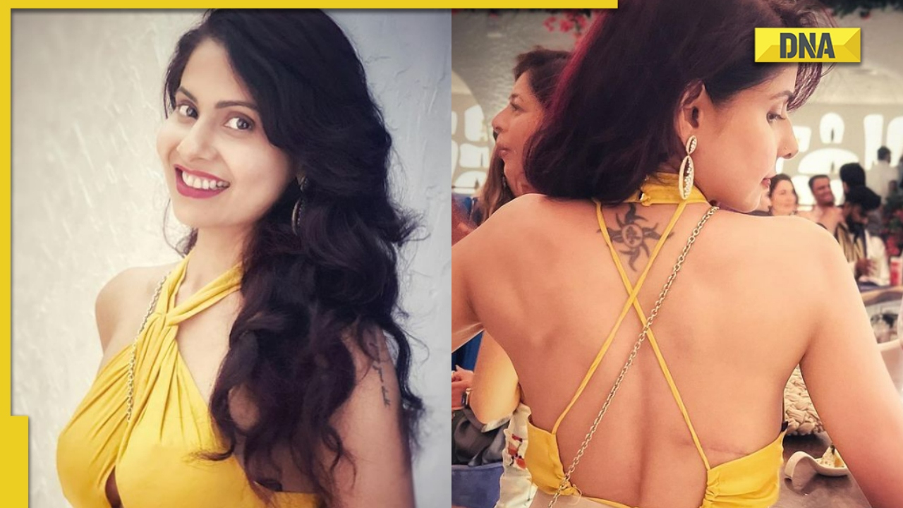 Chhavi Mittal Flaunts Her Breast Cancer Surgery Scar In Backless Dress Netizens Call Her