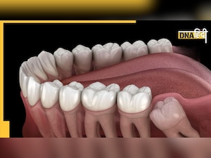 Personality Tips: नुकीले दांत वाले लोग अक्सर आक्रामक होते हैं,  इनसे खुलता है आपके व्यक्तित्व का राज़