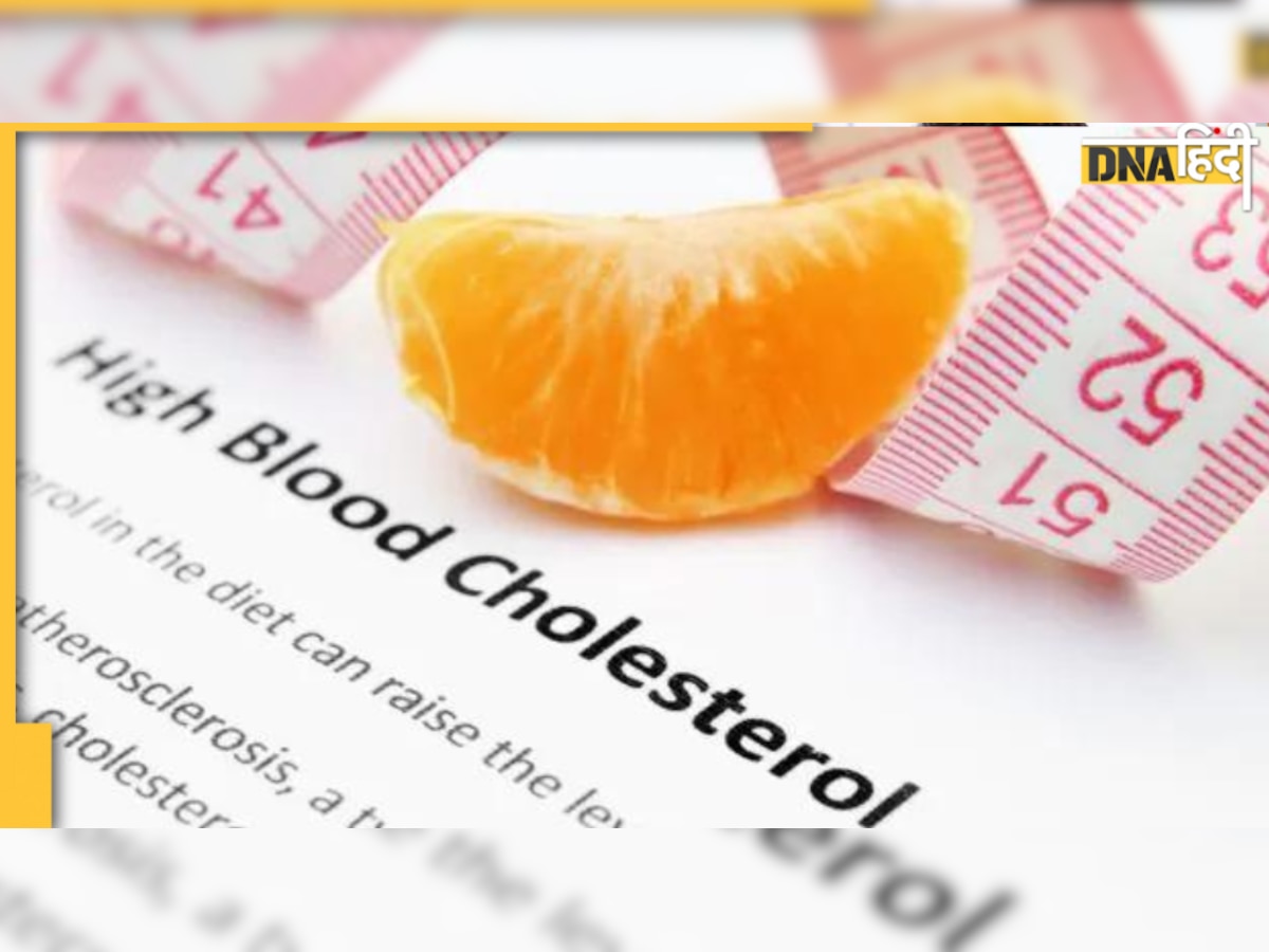 Cholesterol Reduce Tricks: नसों में जकड़े फैट को नर्म बना देंगे ये रसीले फल, कोलेस्ट्रॉल पिघलाने की हैं ये अचूक औषधि 