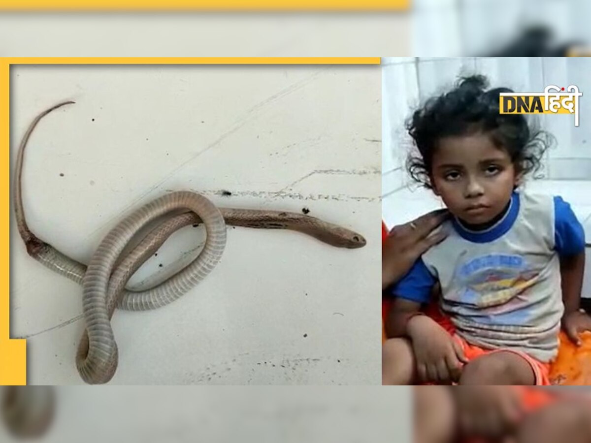 बच्चे को डसते ही मर गया सांप, अब जांच में जुटे डॉक्टर