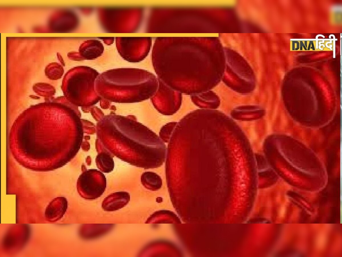 Anemia: खून की कमी की चेतवानी हैं ये 6 समस्‍याएं, एनीमिया से बचना है तो रोज खाएं ये चीजें