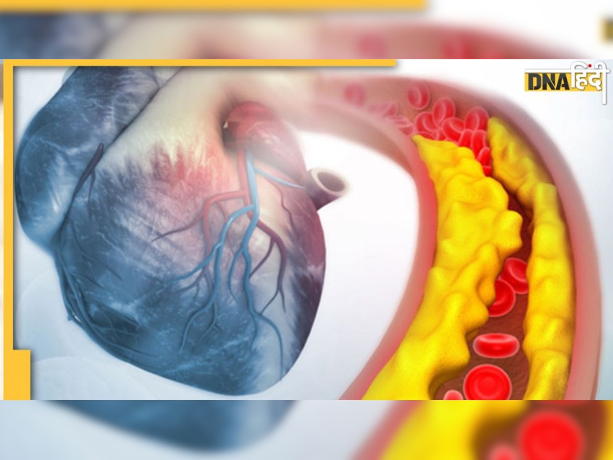 High Cholesterol Diet: हाई कोलेस्ट्रॉल रोगियों के लिए ये हैं 6 हेल्दी फूड ऑप्शन