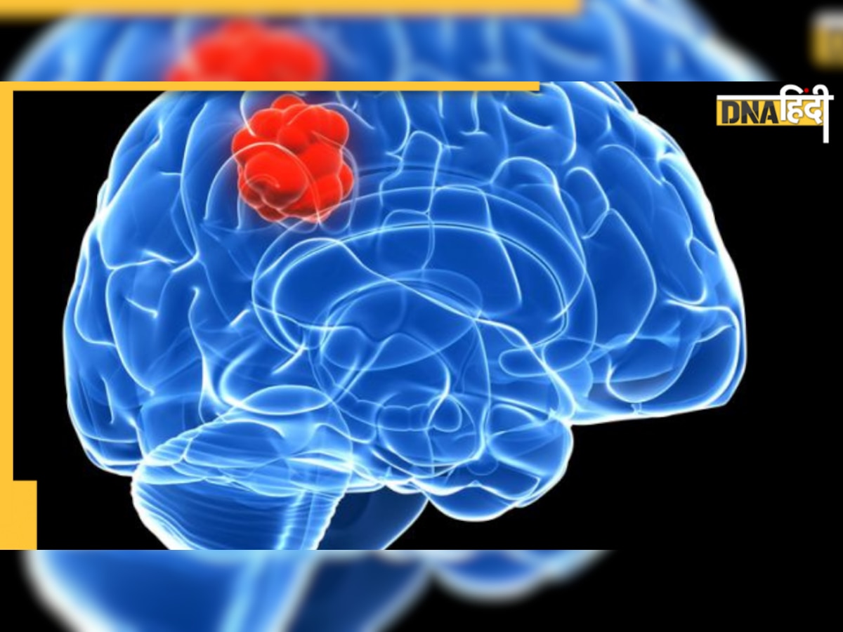 Tumor Symptoms in Body: पुरुष और महिलाओं में दिख रहे हैं ये लक्षण तो न करें इग्नोर