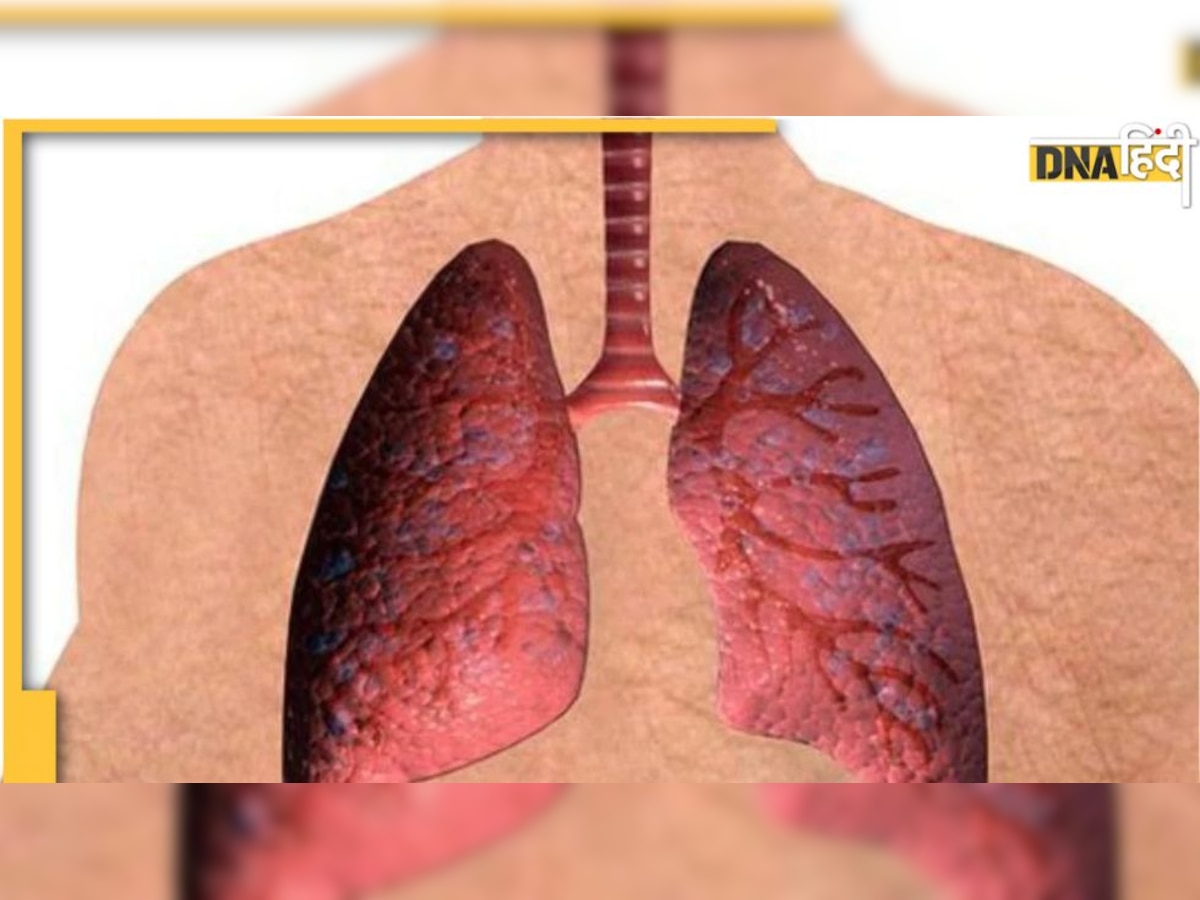 Foods For Lungs: फेफड़े को स्ट्रांग बनाती हैं 6 चीजें, बढ़ेगी लंग्स की स्‍टेमिना