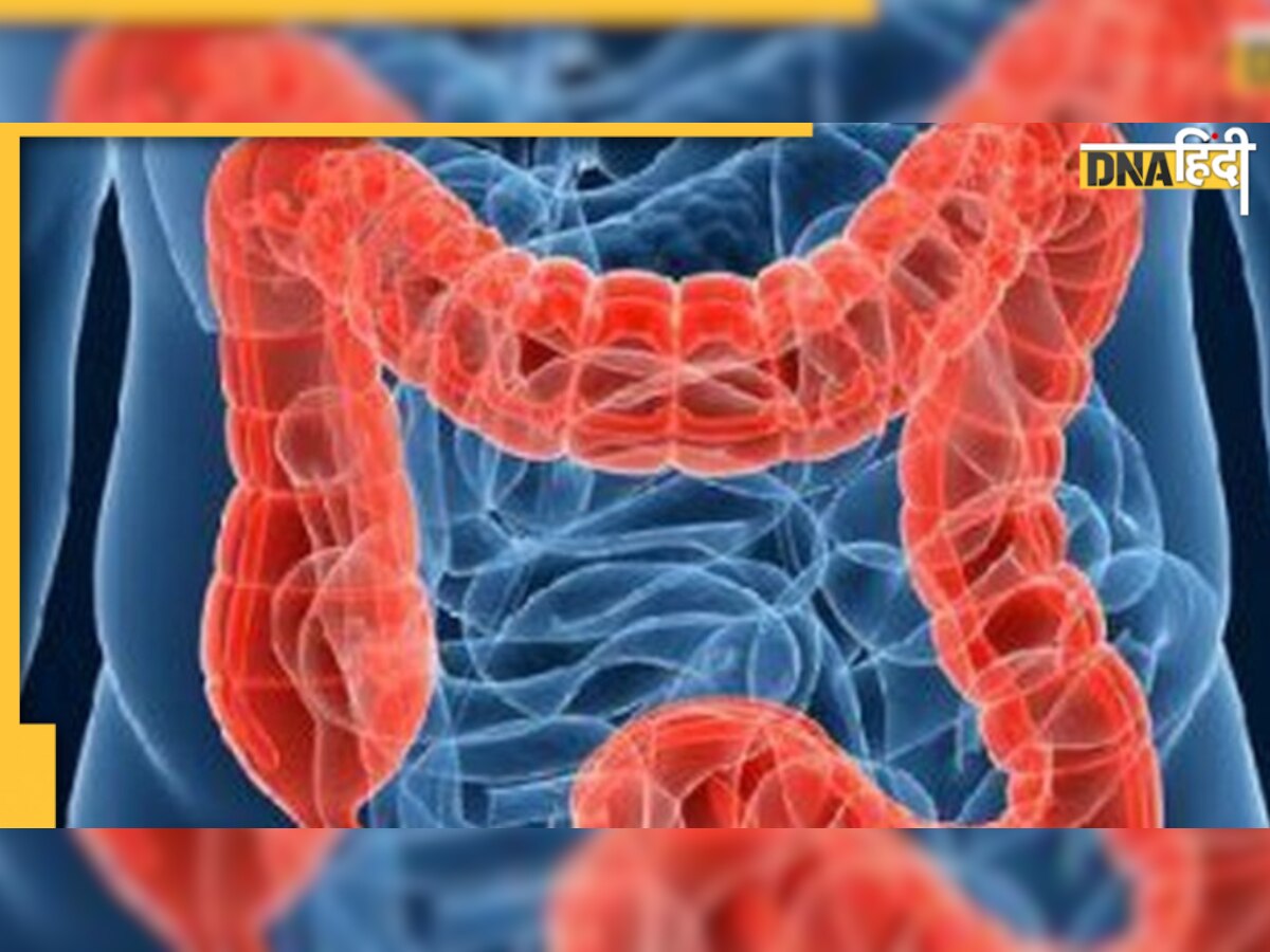 Unhealthy Gut Symptoms: अगर आंतों में दिख रही हैं ये कुछ समस्याएं तो हो जाएं सावधान, इन चीजों से करें परहेज