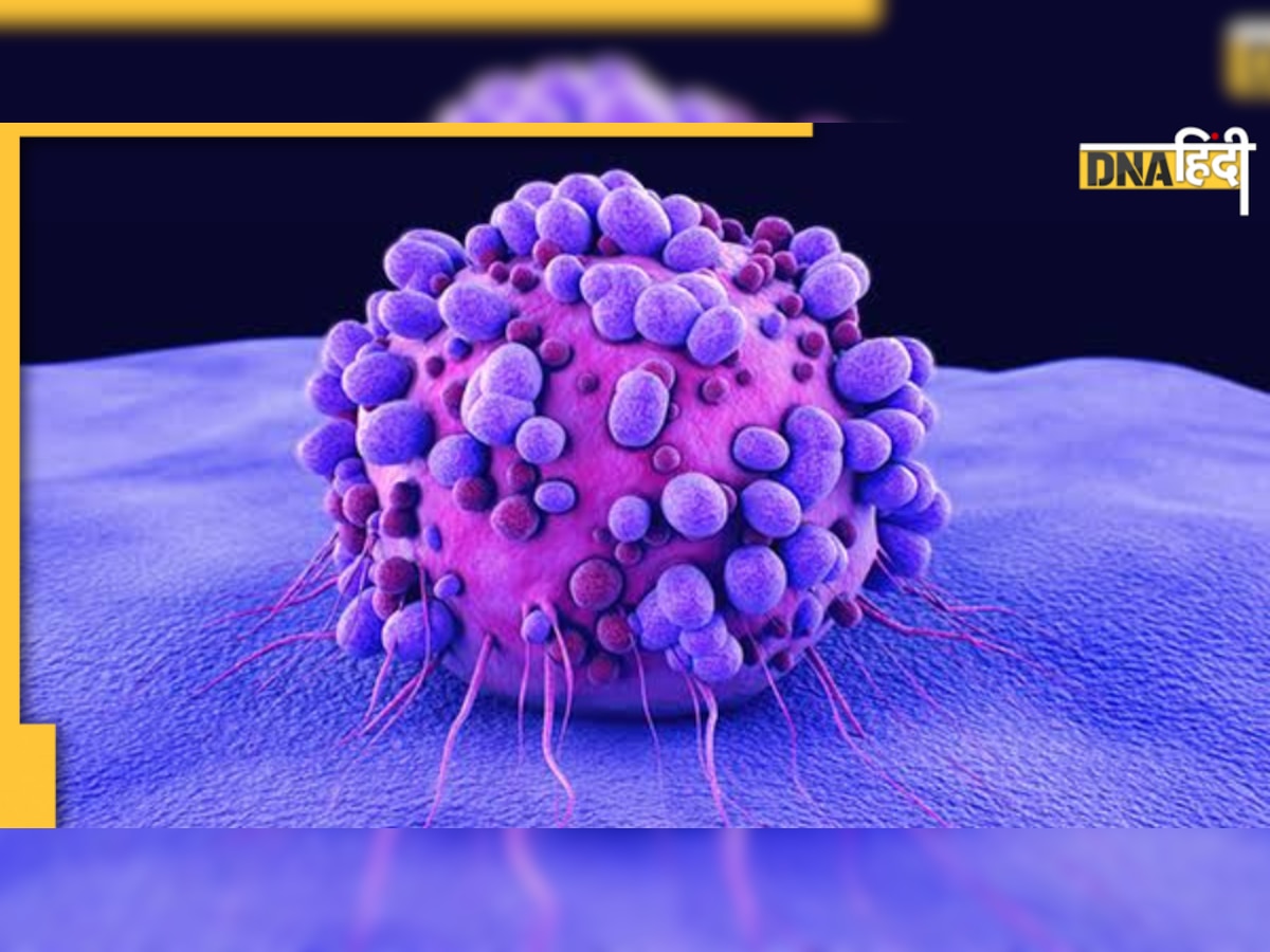 Sarcoma Cancer: शरीर के सॉफ्ट टिश्यूज में होता है यह कैंसर,क्या वाकई इतना खतरनाक है?