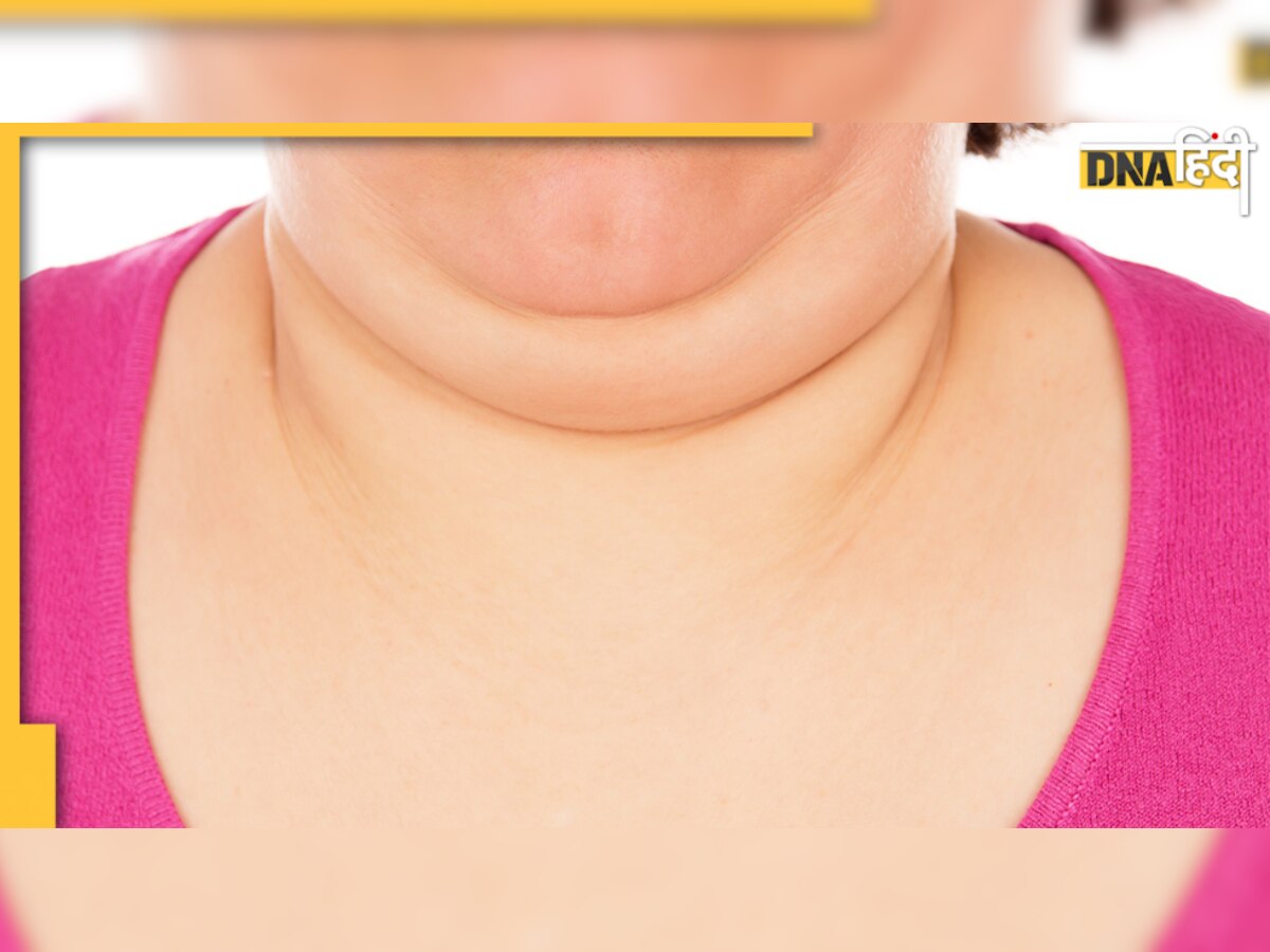 Health Tips: Double Chin की वजह से दिखता है चेहरा मोटा, हटाने के हैं ये आसान से उपाय