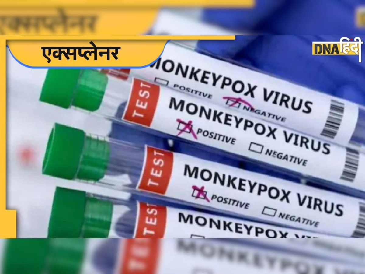 क्या Covid की तरह फैलेगा Monkeypox? क्या जानलेवा है ये बीमारी? जानें क्य�ा कहते हैं डॉक्टर