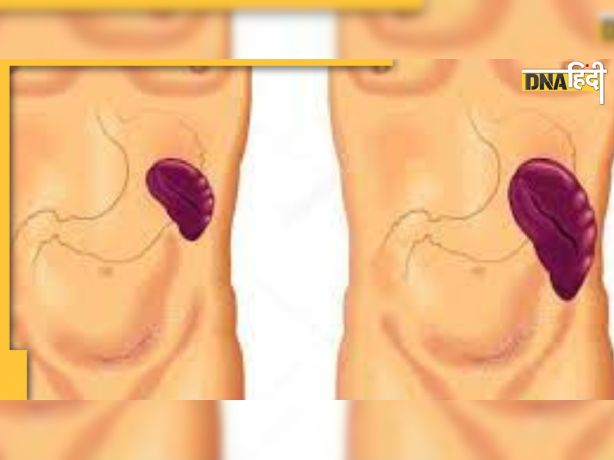 Spleen in Body: अगर तिल्ली का बढ़ गया आकार, तो इग्नोर न करें, जानिए तिल्ली कितना जरूरी अंग है 