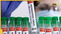 Monekypox के लिए भी वैक्सीन और दवा बनाने की तैयारी, ICMR ने कंपनियों से मांगीं बोलियां