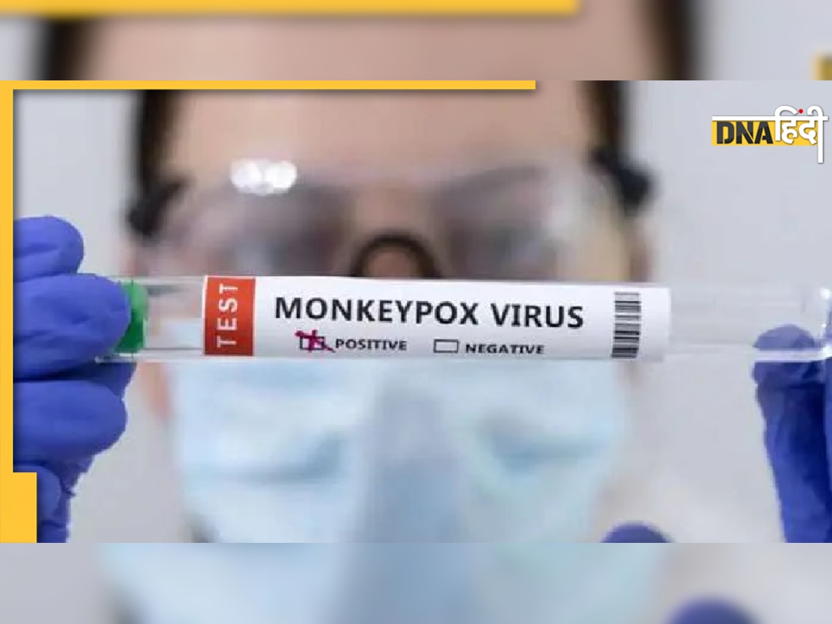 Monkeypox: दिल्ली में लगातार तीसरे दिन मंकीपॉक्स का नया केस, एक विदेशी महिला मिली पॉजिटिव, देश में वैक्सीन की तैयारी तेज