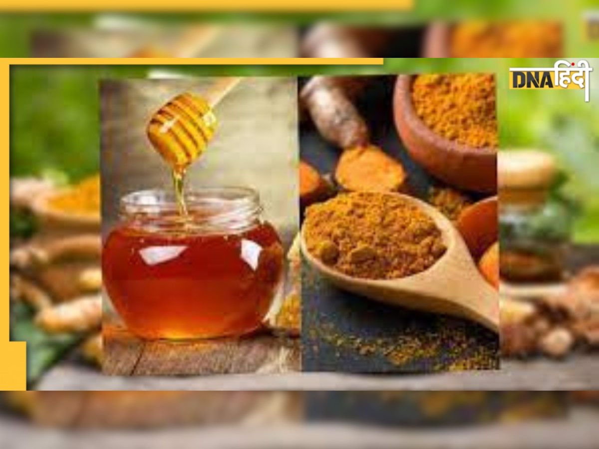 Turmeric in Uric Acid Control: किचन की ये चीज 1 महीने में कर देगी यूरिक एसिड खत्म, जानिए कैसे करें सेवन 