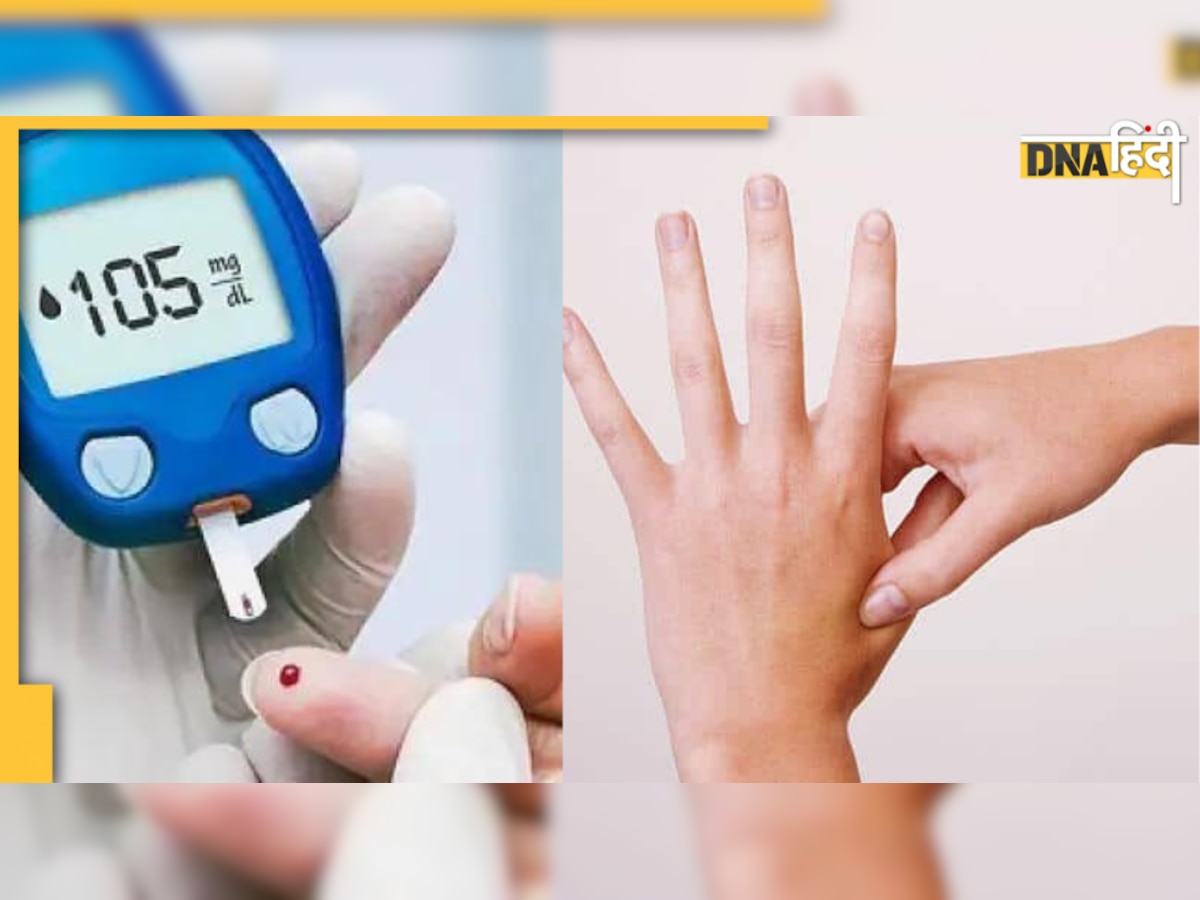 Acupressure in Diabetes: अचानक हो गया शुगर लेवल High, एक मिनट इन Points को दबाने से हो जाएंगे ठीक 