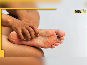Burning feet : पैरों में दर्द और तलवे में जलन के पीछे हो सकती हैं ये गंभीर बीमारियां