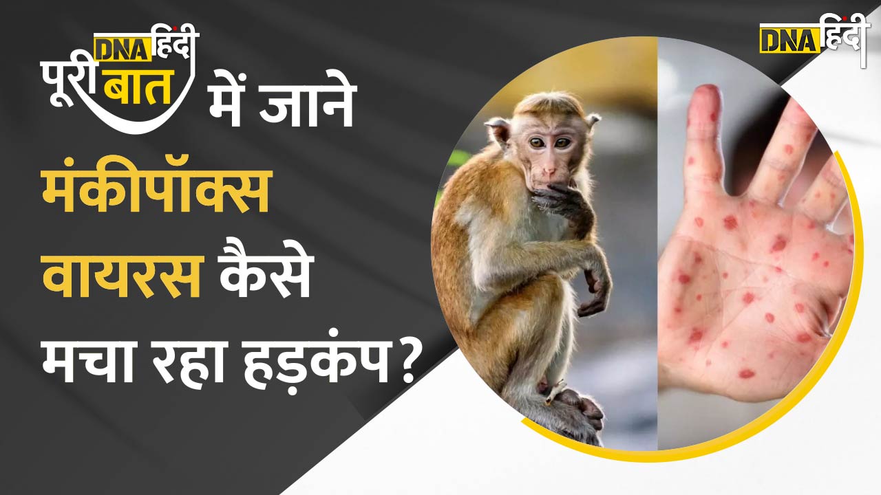 Video : DNA Hindi पूरी बात में जाने Monkeypox Virus कैसे मचा रहा हड़कंप?