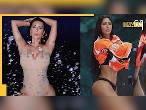 Kim Kardashian ने पेट को टाइट करवाने के लिए झेला असहनीय दर्द, शेयर कीं Laser ट्रीटमेंट की तस्वीरें