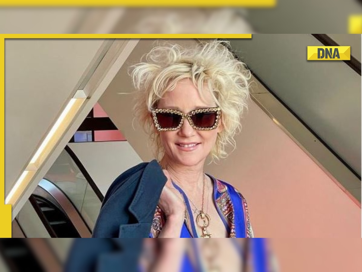 Anne Heche, Six Days Seven Nights actress, severely burned in car crash