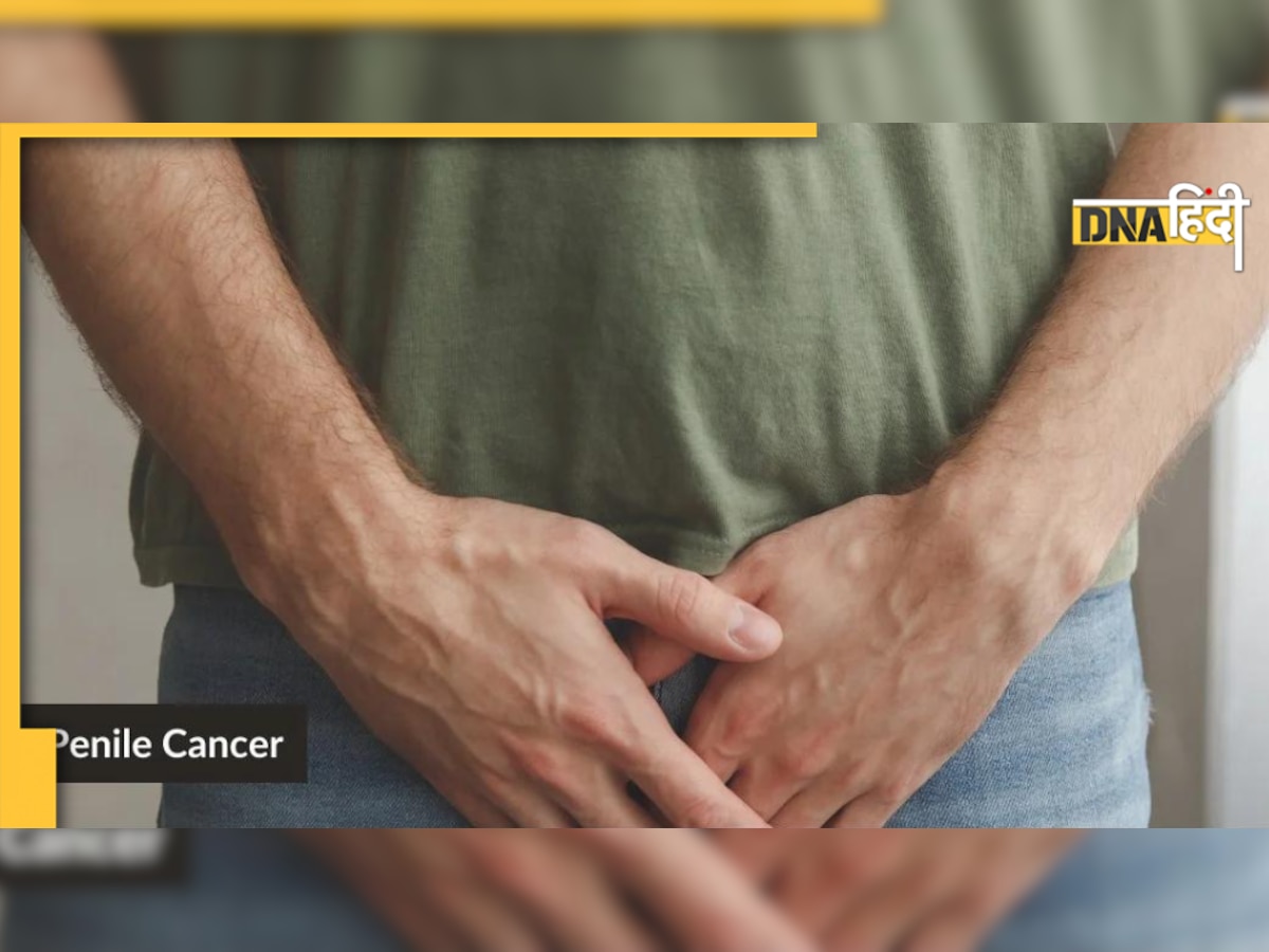 Penile Cancer: लिंग में छोटी सी गांठ या सूजन बन सकती है घातक, इन लक्षणों से पहचानें और तुरंत करें इलाज