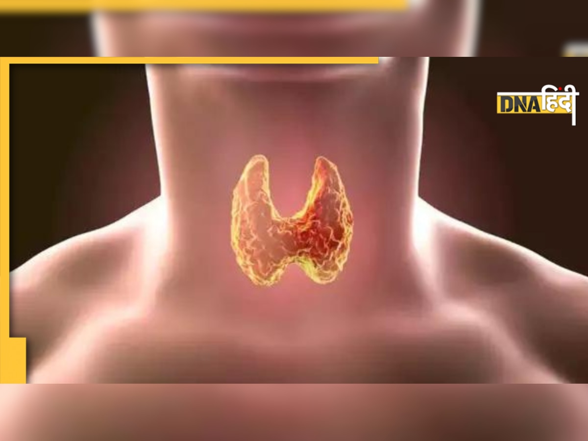 Mens Health Problem: पुरुषों में थाइरॉयड बढ़ने के ये हैं लक्षण, वजन कम होना समेत 5 बीमारियां होती हैं पैदा 