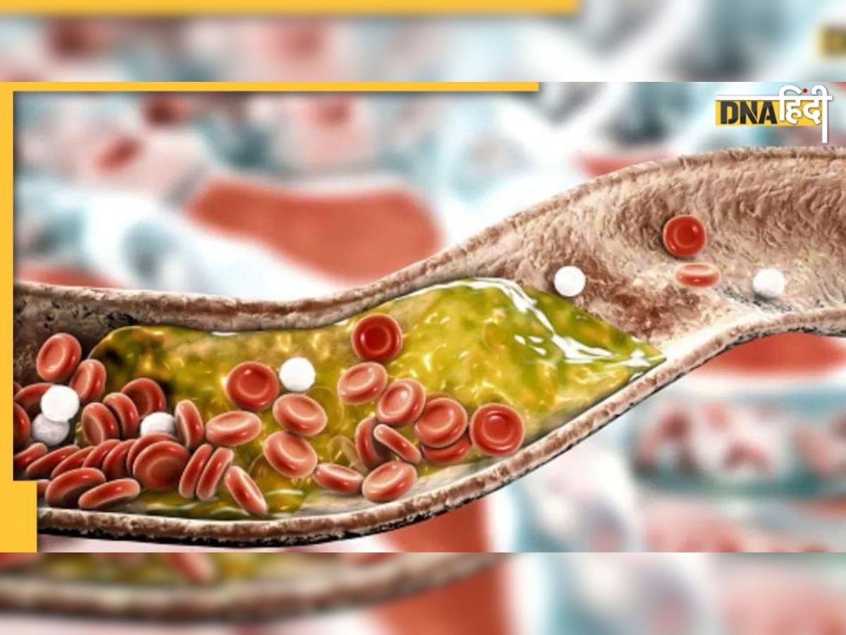 Cholesterol Diet: कोलेस्ट्रॉल को बढ़ने से रोक देती हैं ये सब्जियां, नसों में जकड़ी वसा तेजी पिघलेगी