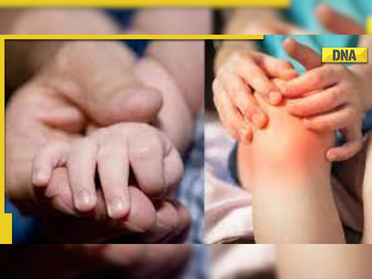 Arthritis in children: Know warning signs of early onset of the disease 